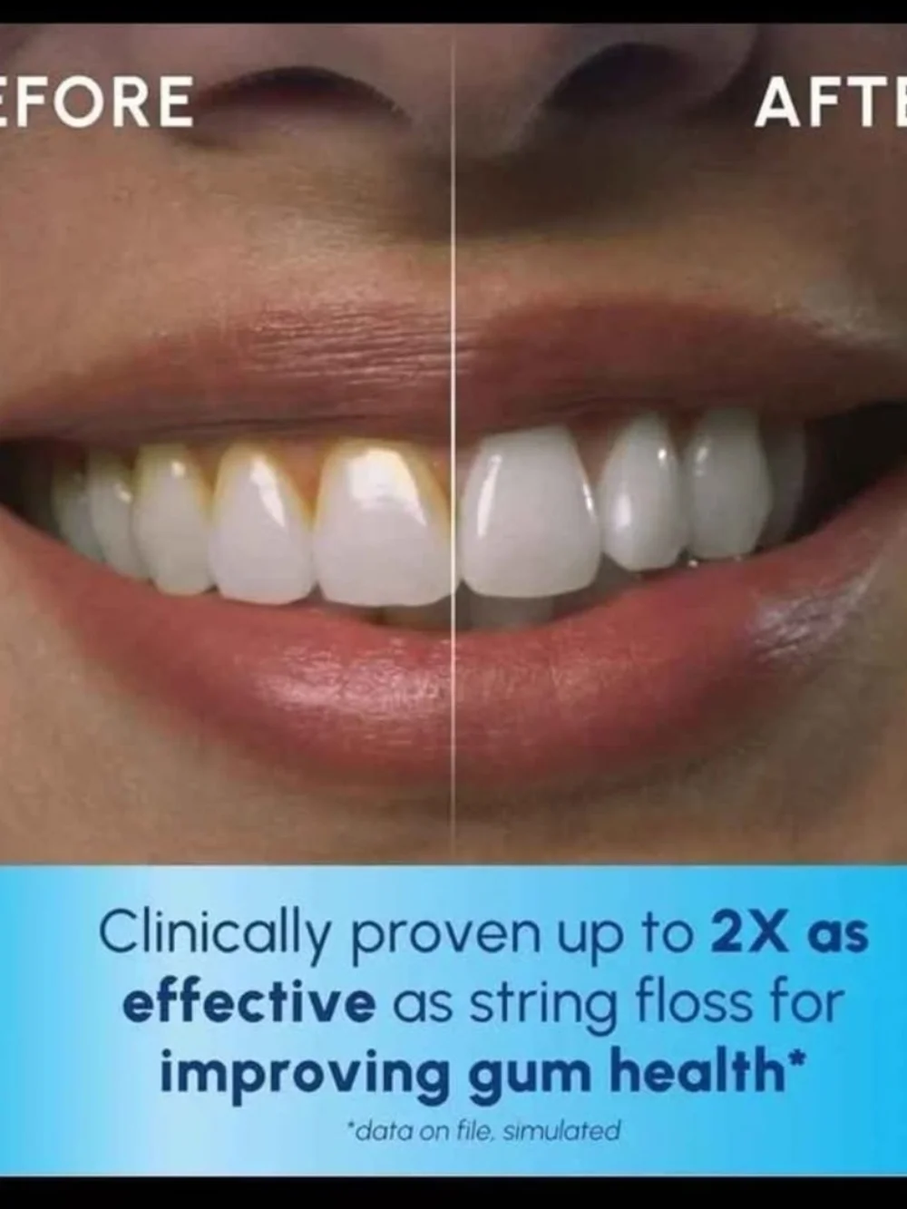 Waterpik Cordless Pearl Water Flosser Rechargeable Oral Irrigator 4 Tips ADA A3